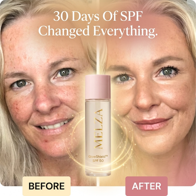 Melza GlowShield™ SPF 50